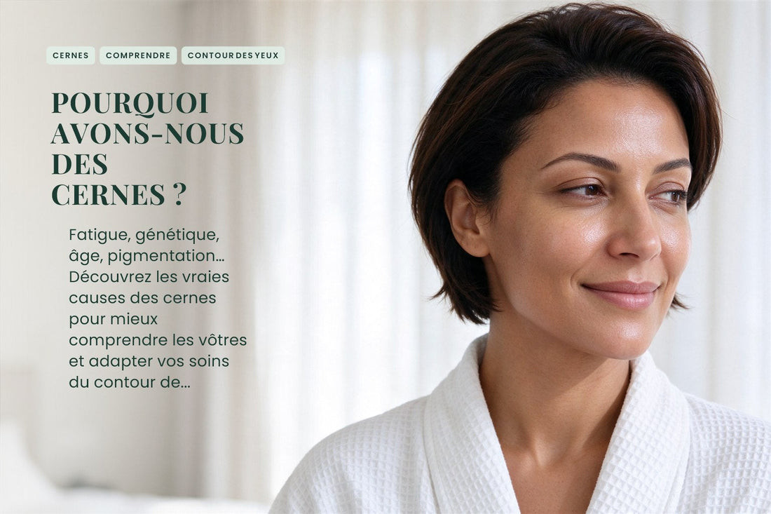 Pourquoi avons-nous des cernes ?